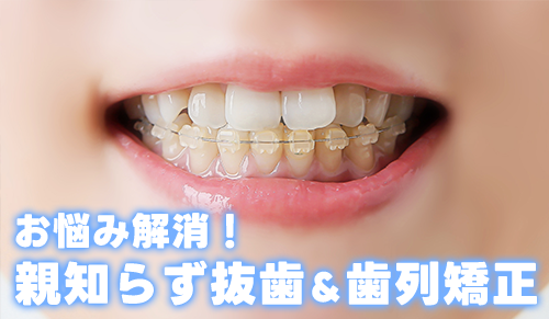 親知らずと歯列矯正：最適な抜歯タイミングとそのメリット・デメリット
